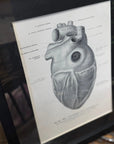 Framed Antique Anatomy Print 1920s Medical Book Plate Wall Art Picture T