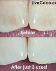Teeth Cleaning Powder (Vitamins & Aloe Vera Infused)