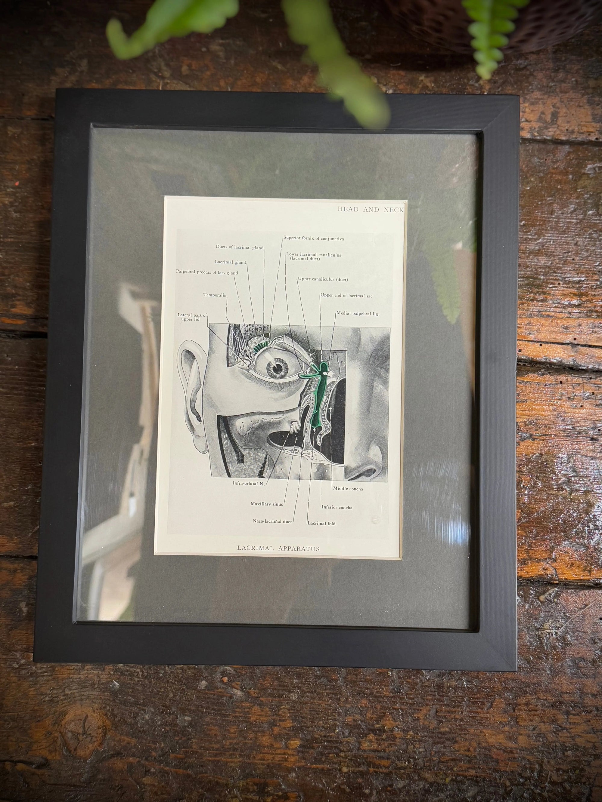 Framed Antique Anatomy Print 1920s Medical Book Plate Wall Art Picture C