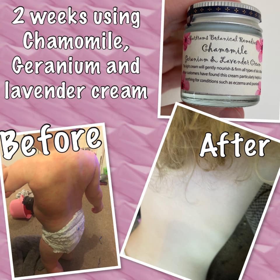 Chamomile Geranium &amp; Lavender Cream - Transform Your Skin, Transform Your Life!
