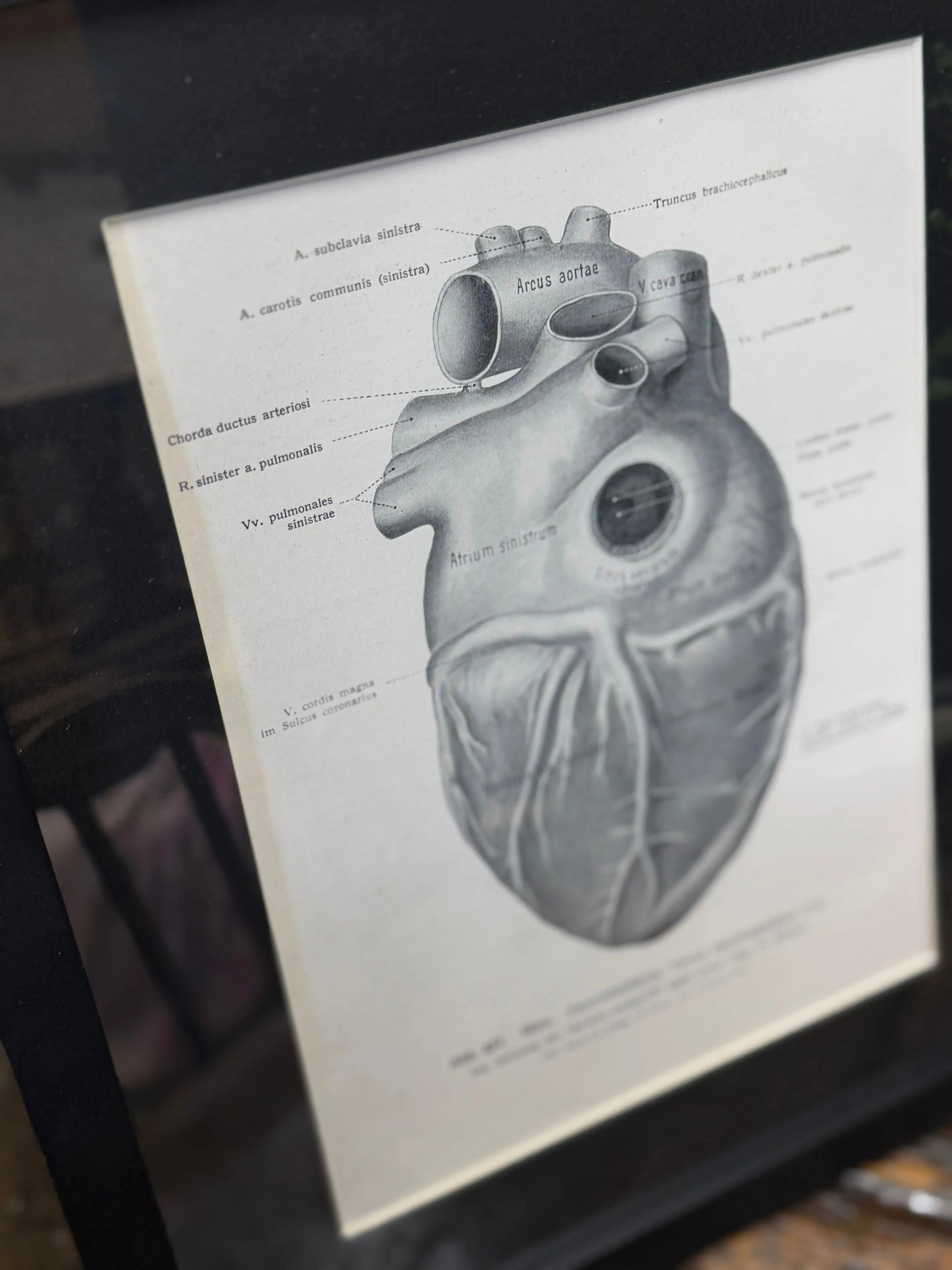 Framed Antique Anatomy Print 1920s Medical Book Plate Wall Art Picture T