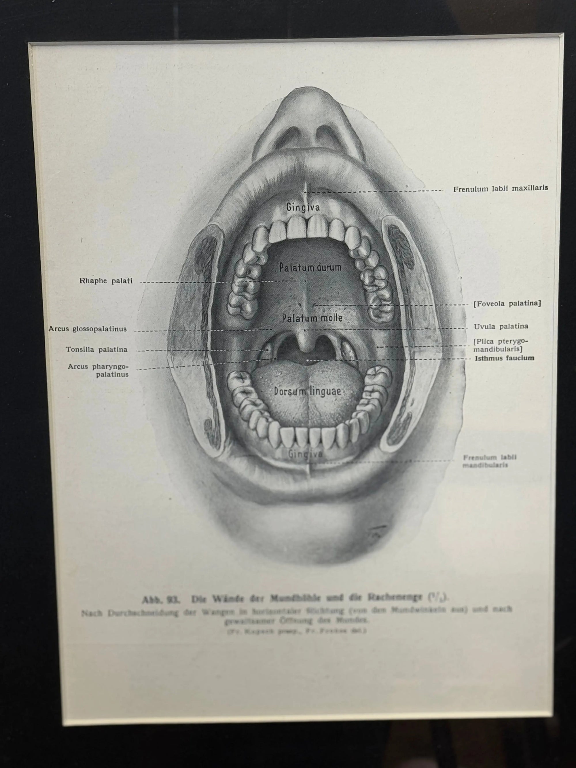 Victorian Anatomy Engraving – Antique Medical Print R