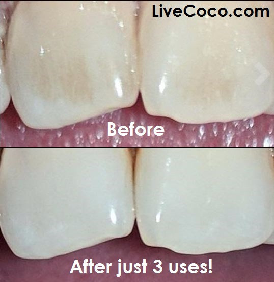 Teeth Cleaning Powder (Vitamins &amp; Aloe Vera Infused)