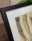 Victorian Anatomy Engraving – Antique Medical Print S