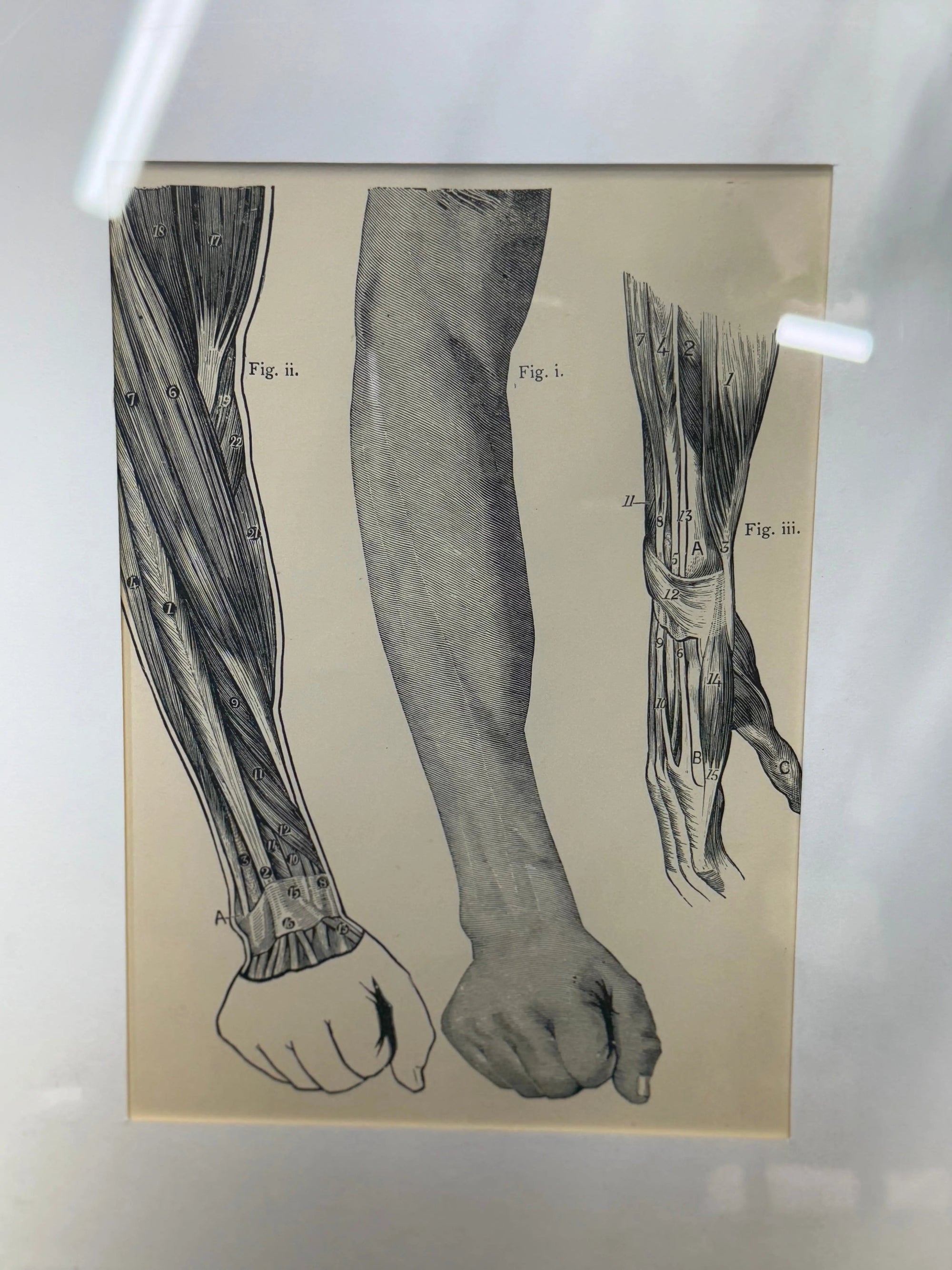 Victorian Anatomy Engraving – Antique Medical Print S