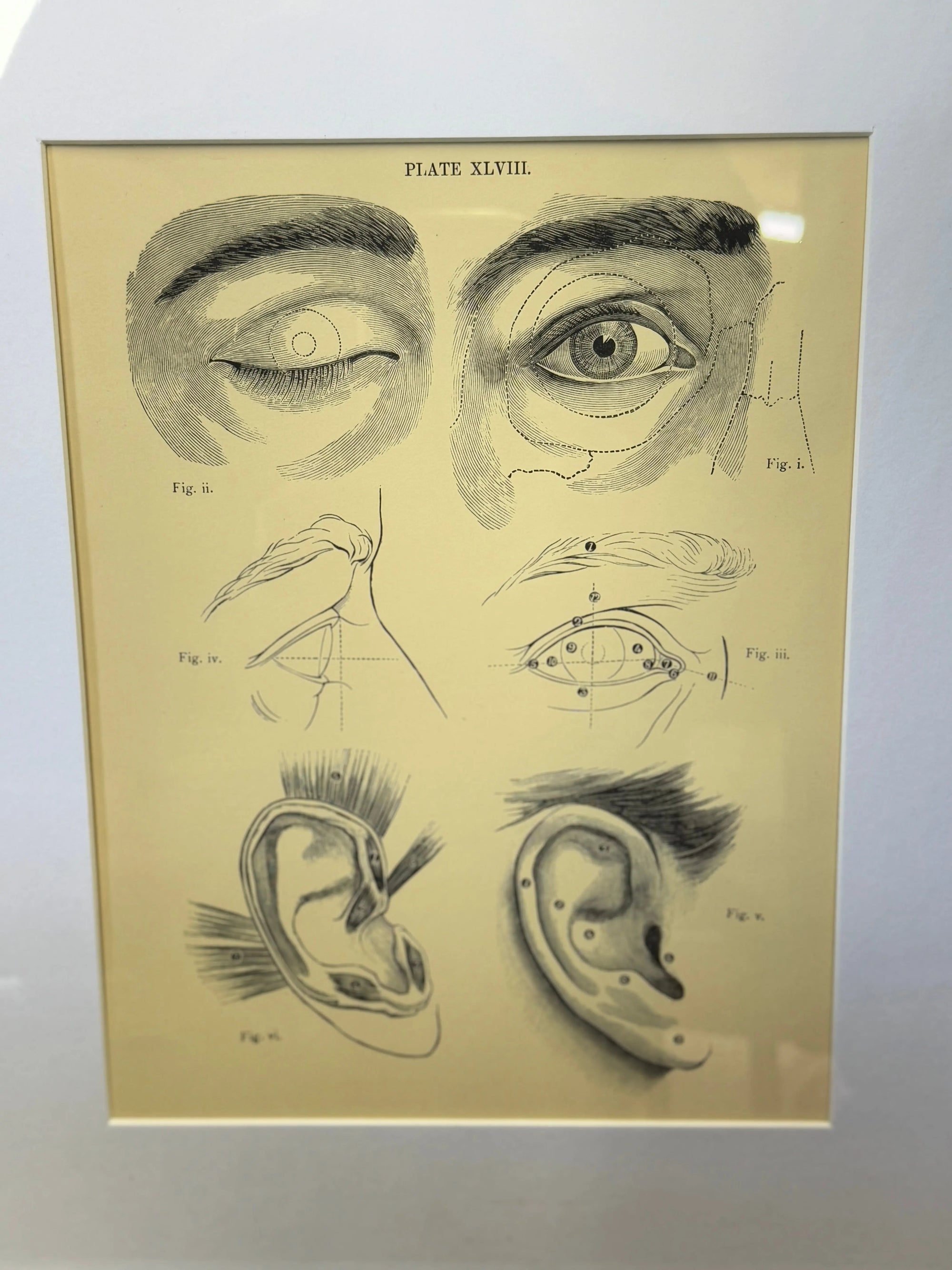 Victorian Anatomy Engraving – Antique Medical Print P