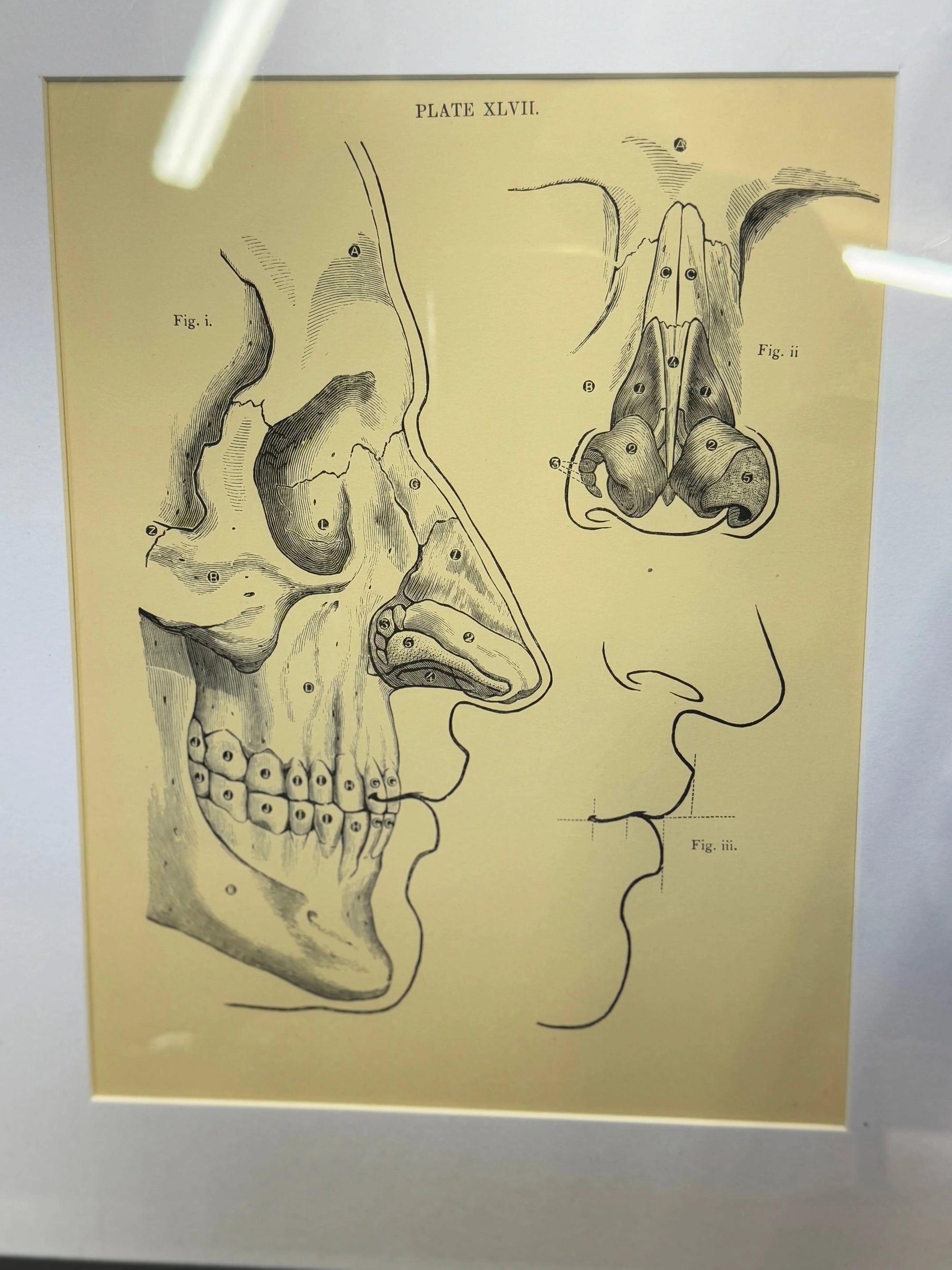 Victorian Anatomy Engraving – Antique Medical Print L