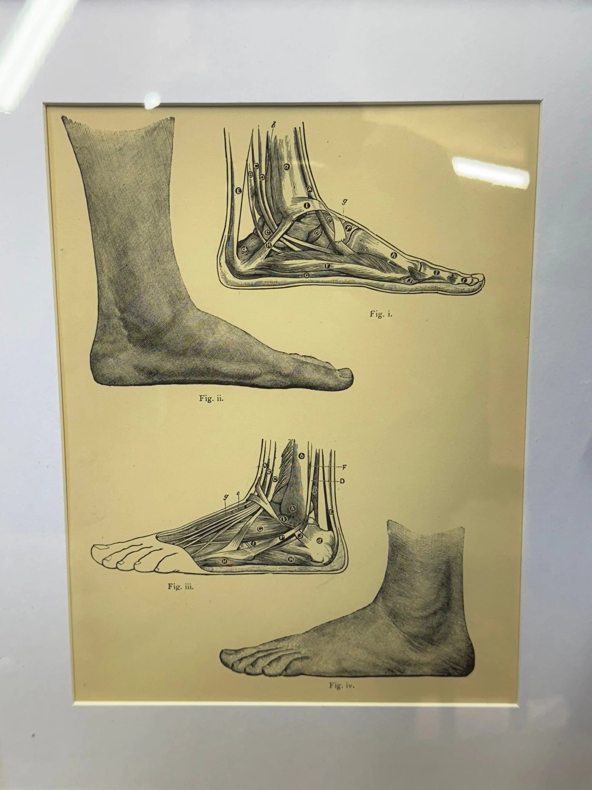 Victorian Anatomy Engraving – Antique Medical Print M