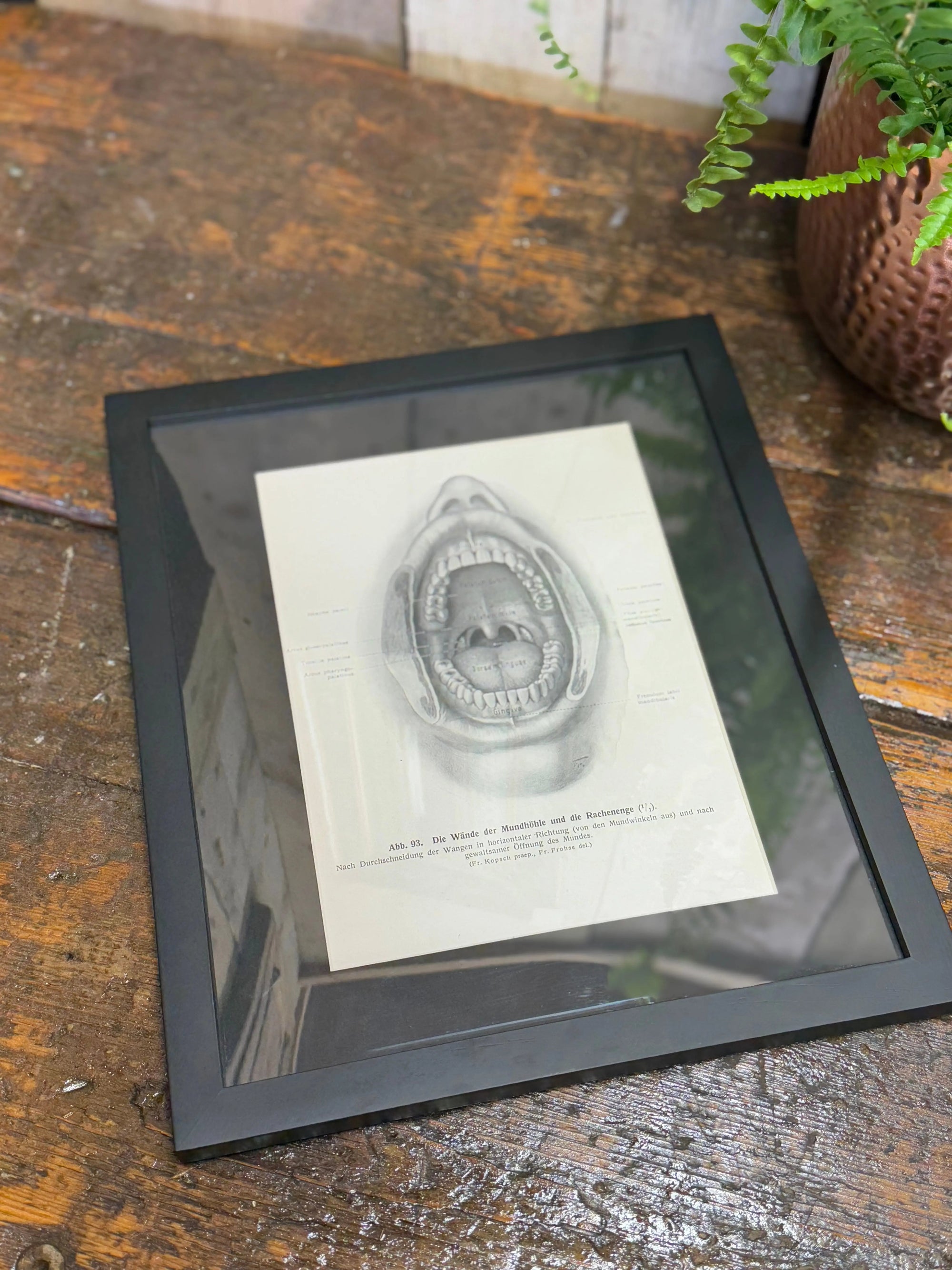 Victorian Anatomy Engraving – Antique Medical Print R