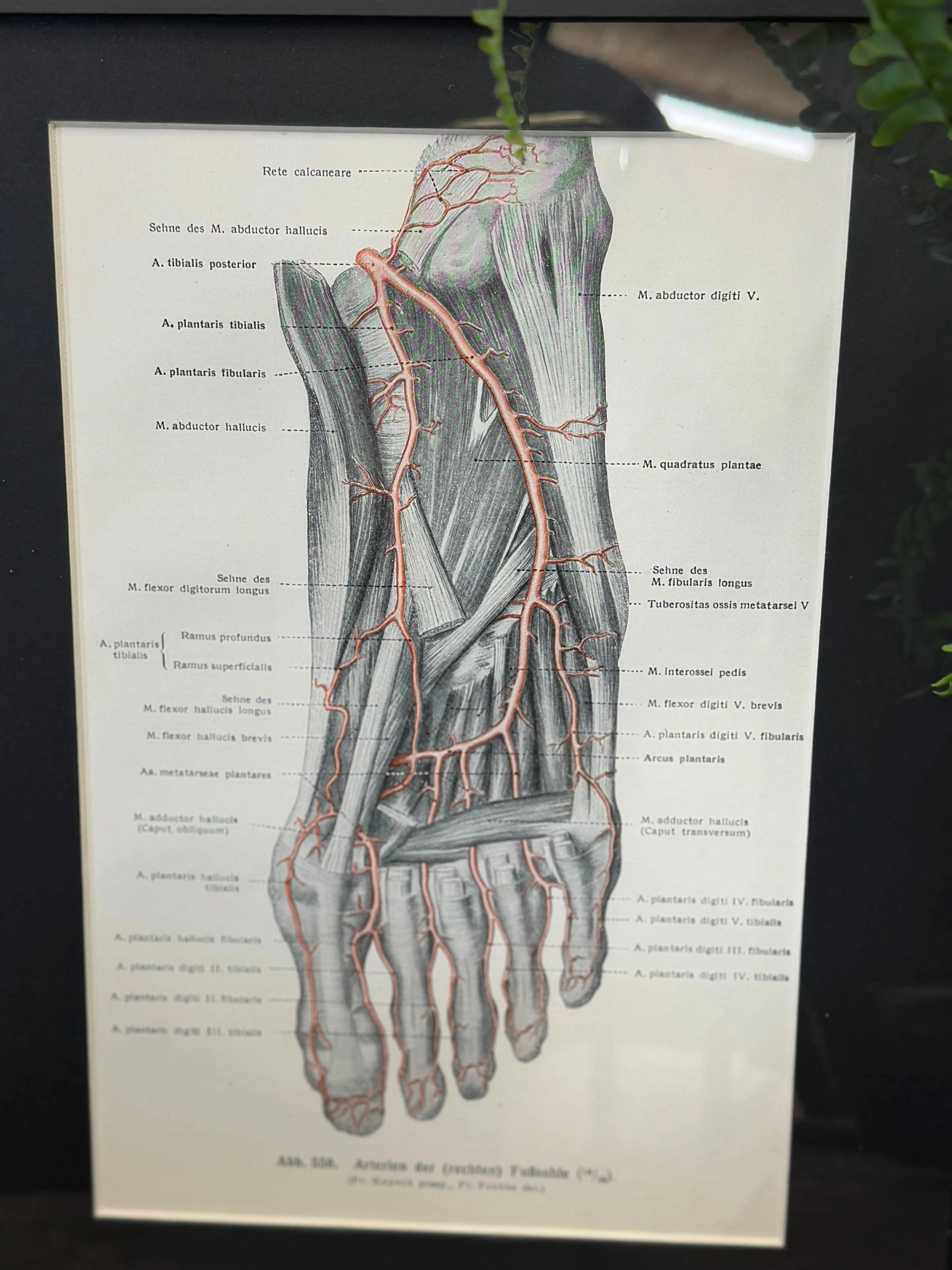 Framed Antique Anatomy Print 1920s Medical Book Plate Wall Art Picture I